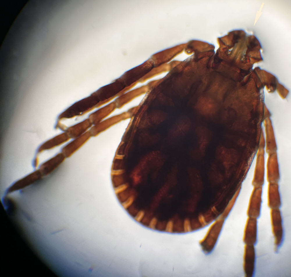 Tick Bombs and an Invasive Tick: What Tick Boot Camp and Researchers Found While Dragging for Ticks on Long Island 8 Invasive Asian longhorned tick collected in Coram, New York, on Long Island and examined under a microscope